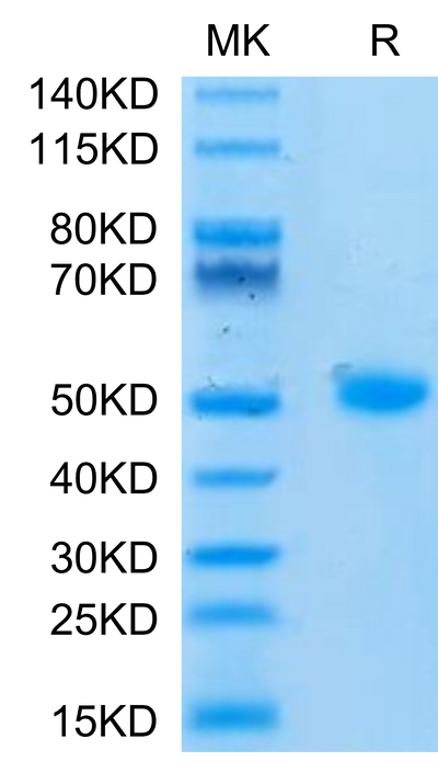 Human CD209 on Tris-Bis PAGE under reduced condition. The purity is greater than 95%.Recombinant Human CD209/DC-SIGN Protein, Active