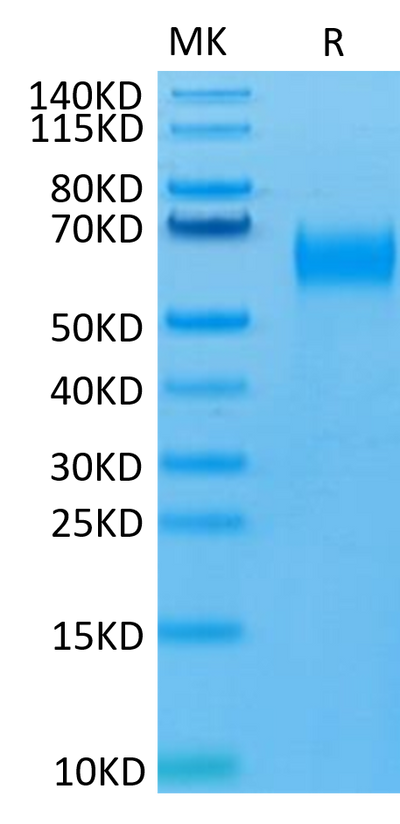 Human SIRP Beta 1 isoform 3 on Tris-Bis PAGE under reduced condition. The purity is greater than 95%.Recombinant Human SIRP Beta 1 isoform 3 Protein