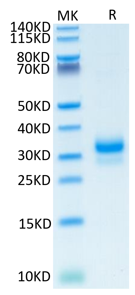 Human TFPI-2 on Tris-Bis PAGE under reduced condition. The purity is greater than 95%.Recombinant Human TFPI-2 Protein