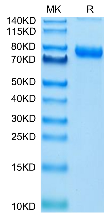Cynomolgus Transferrin R on Tris-Bis PAGE under reduced condition. The purity is greater than 95%.Recombinant Cynomolgus Transferrin R/CD71 Protein