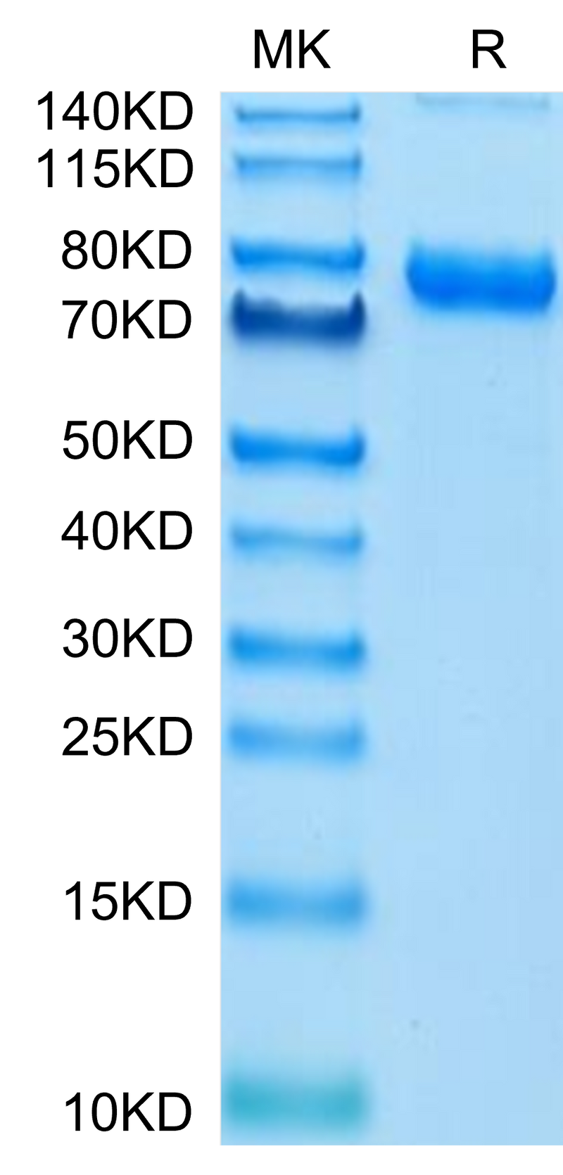 Cynomolgus Transferrin R on Tris-Bis PAGE under reduced condition. The purity is greater than 95%.Recombinant Cynomolgus Transferrin R/CD71 Protein