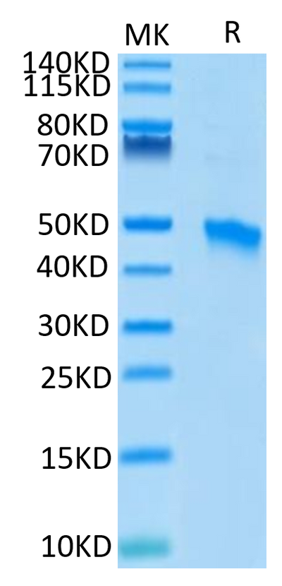 Human VSIG4 on Tris-Bis PAGE under reduced condition. The purity is greater than 95%.Recombinant Human VSIG4 Protein