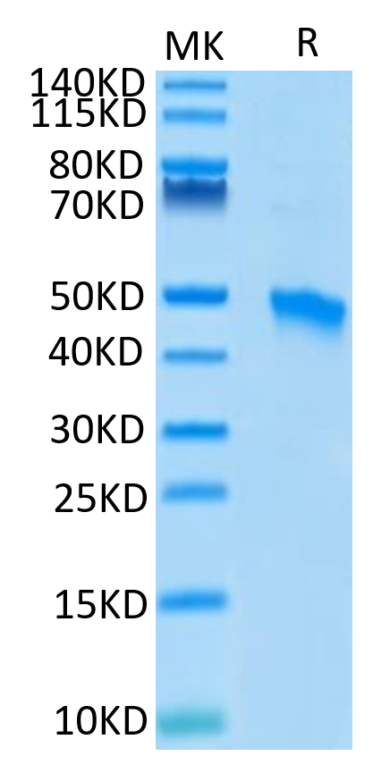 Human VSIG4 on Tris-Bis PAGE under reduced condition. The purity is greater than 95%.Recombinant Human VSIG4 Protein