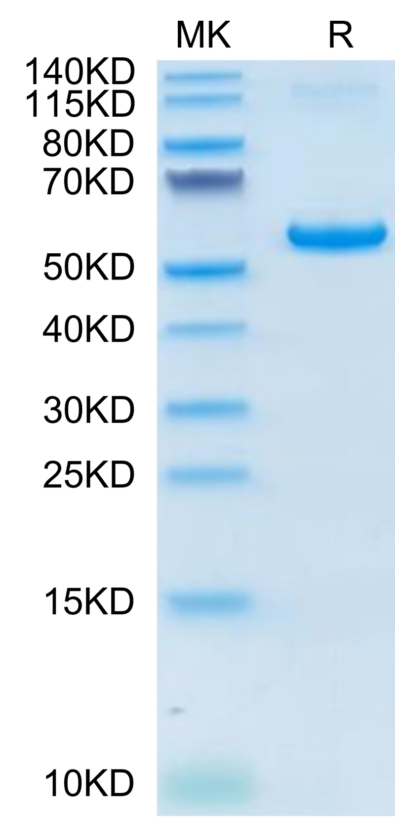 Human VSIG8 on Tris-Bis PAGE under reduced condition. The purity is greater than 95%.Recombinant Human VSIG8 Protein