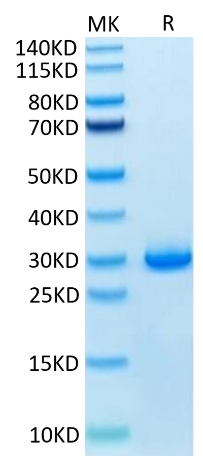 Human VSIG8 on Tris-Bis PAGE under reduced condition. The purity is greater than 95%.Recombinant Human VSIG8 Protein