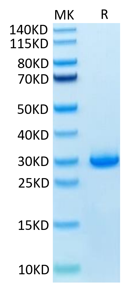 Human VSIG8 on Tris-Bis PAGE under reduced condition. The purity is greater than 95%.Recombinant Human VSIG8 Protein