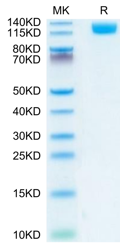 Mouse OSMR on Tris-Bis PAGE under reduced condition. The purity is greater than 95%.Recombinant Mouse OSMR Protein