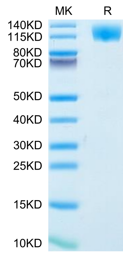 Human OSMR on Tris-Bis PAGE under reduced condition. The purity is greater than 95%.Recombinant Human OSMR Protein, Active