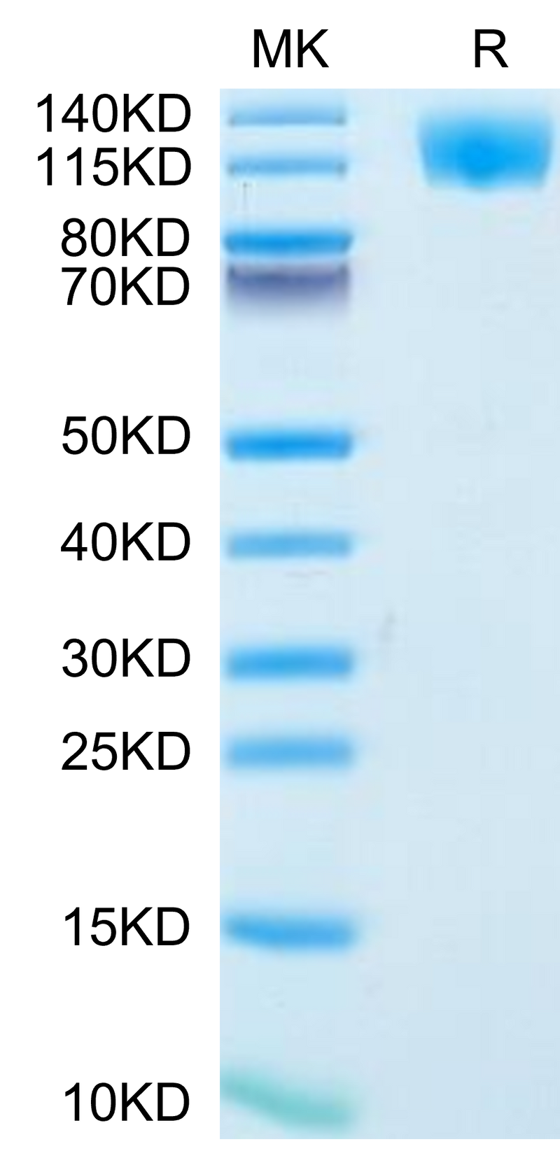 Human OSMR on Tris-Bis PAGE under reduced condition. The purity is greater than 95%.Recombinant Human OSMR Protein, Active