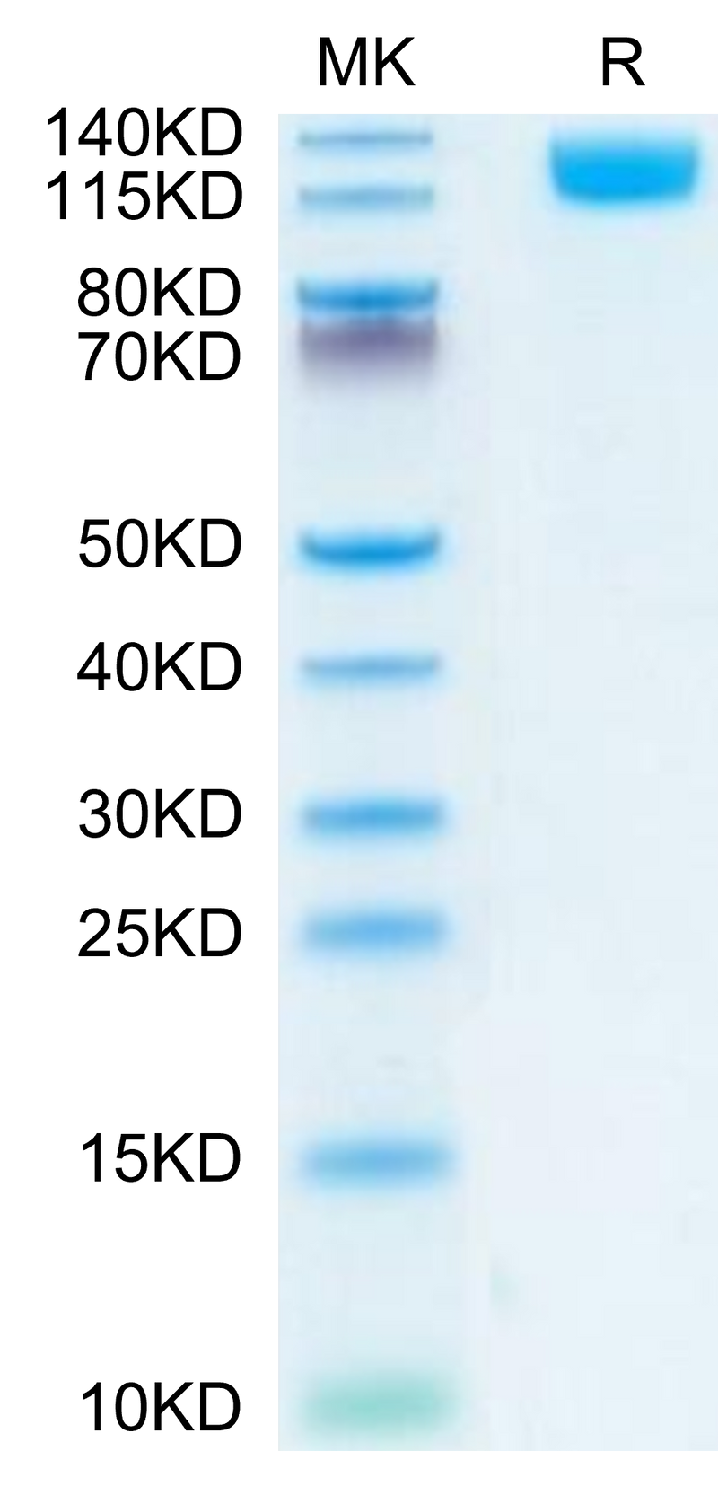 Mouse OSMR on Tris-Bis PAGE under reduced condition. The purity is greater than 95%.Recombinant Mouse OSMR Protein