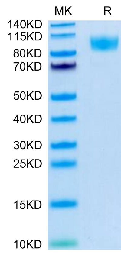 Biotinylated Human CD45 on Tris-Bis PAGE under reduced condition. The purity is greater than 95%.Biotinylated Human CD45/PTPRC Protein, Active
