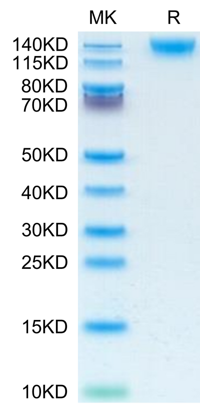 Human CD45 on Tris-Bis PAGE under reduced condition. The purity is greater than 95%.Recombinant Human CD45/PTPRC Protein, Active
