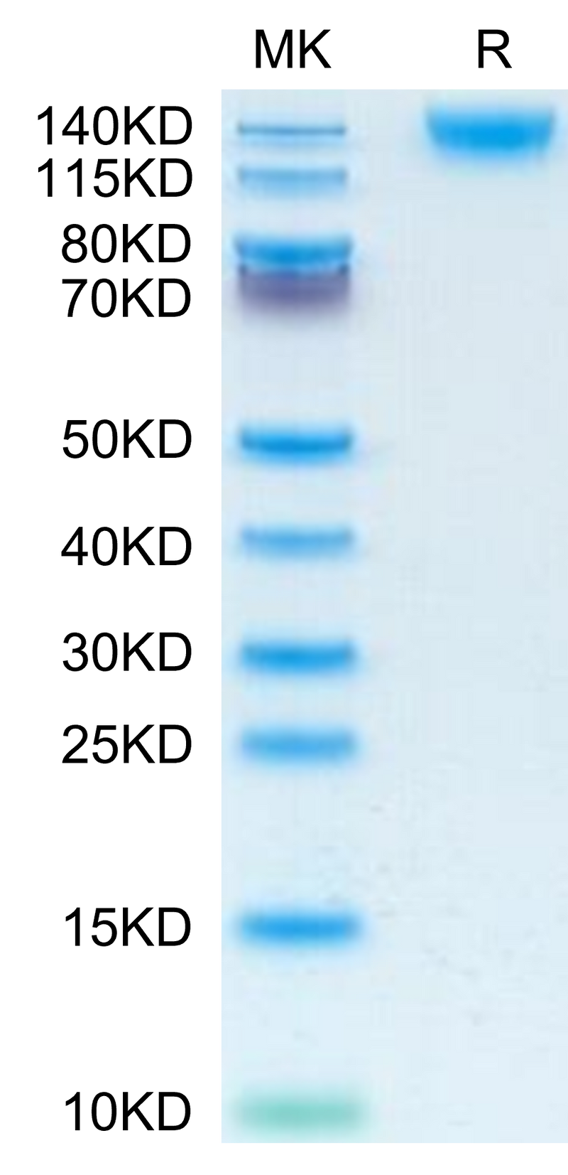 Human CD45 on Tris-Bis PAGE under reduced condition. The purity is greater than 95%.Recombinant Human CD45/PTPRC Protein, Active