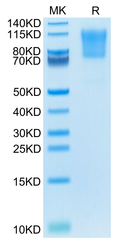 Human PSGL-1 on Tris-Bis PAGE under reduced condition. The purity is greater than 95%.Recombinant Human PSGL-1 Protein