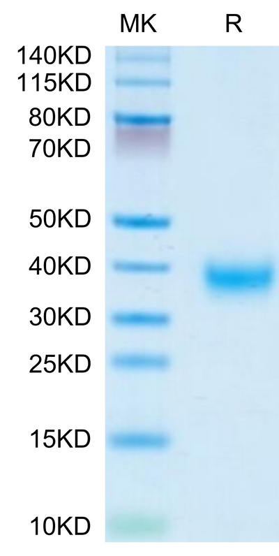 Human LAYN on Tris-Bis PAGE under reduced condition. The purity is greater than 95%.Recombinant Human LAYN Protein