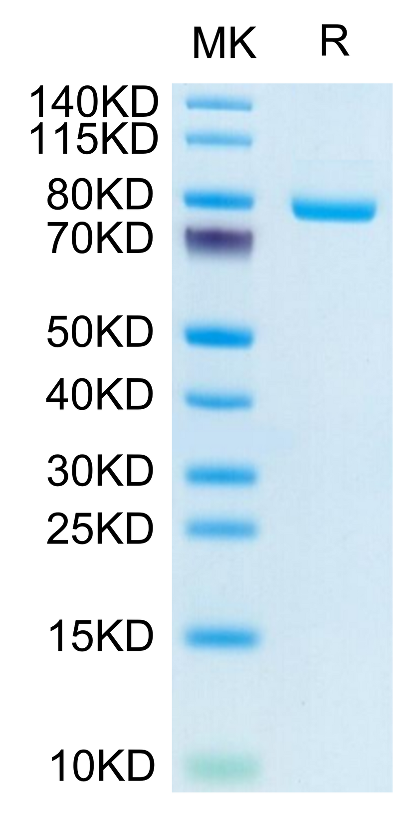 Human Transferrin R on Tris-Bis PAGE under reduced condition. The purity is greater than 95%.Recombinant Human Transferrin R/CD71 Protein, Active