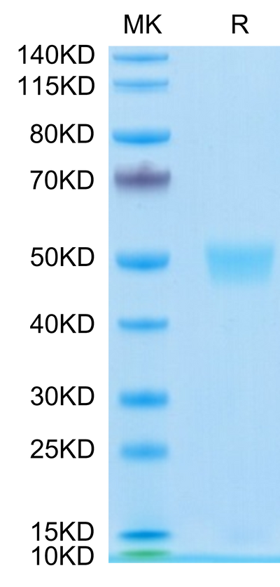 Human LRG1 on Tris-Bis PAGE under reduced condition. The purity is greater than 95%.Recombinant Human LRG1 Protein, Active