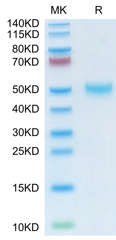 Mouse LRG1 on Tris-Bis PAGE under reduced condition. The purity is greater than 95%.Recombinant Mouse LRG1 Protein