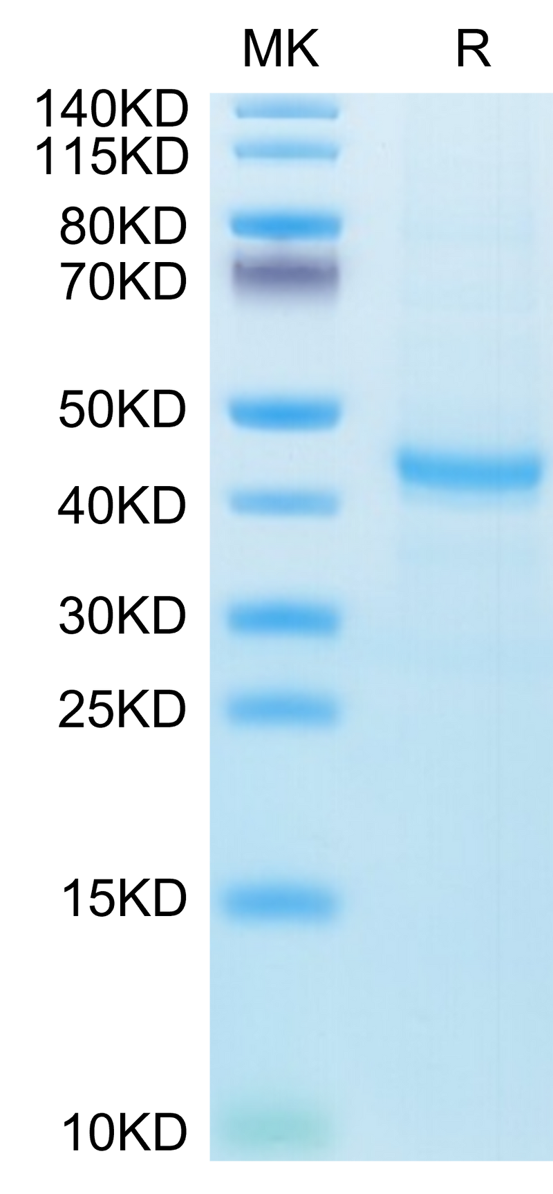 Human CXCL13 on Tris-Bis PAGE under reduced condition. The purity is greater than 95%.Recombinant Human CXCL13/BCA-1 Protein, Active