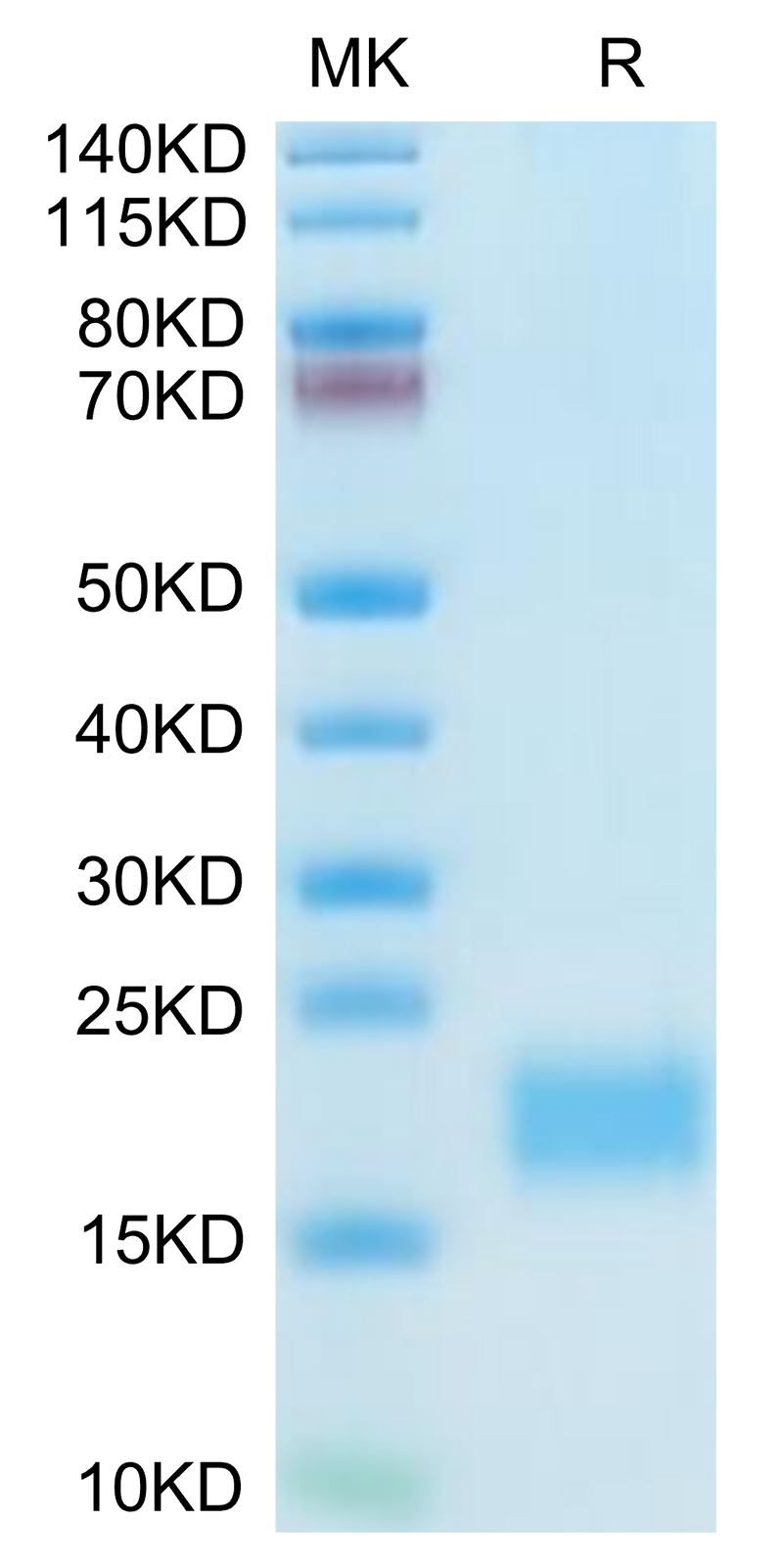 Mouse CXCL13 on Tris-Bis PAGE under reduced condition. The purity is greater than 95%.Recombinant Mouse CXCL13/BCA-1 Protein