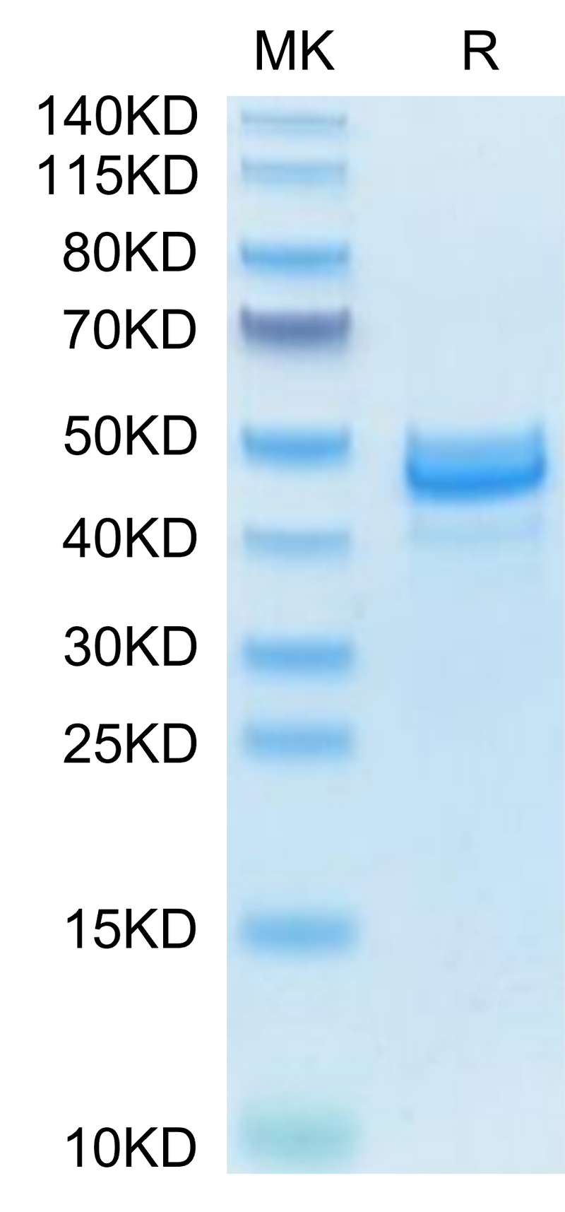 Mouse AREG on Tris-Bis PAGE under reduced condition. The purity is greater than 95%.Recombinant Mouse AREG Protein