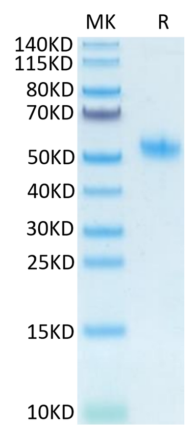 Mouse SPP1 on Tris-Bis PAGE under reduced condition. The purity is greater than 95%.Recombinant Mouse SPP1/OPN Protein