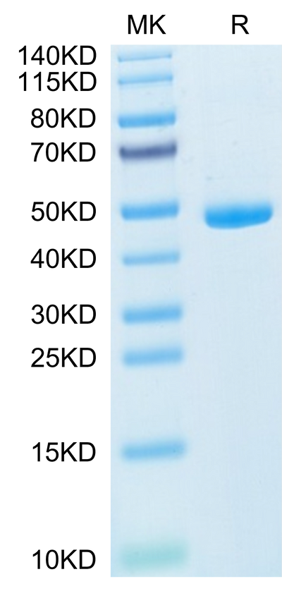 Mouse IL-20 on Tris-Bis PAGE under reduced condition. The purity is greater than 95%.Recombinant Mouse IL-20 Protein