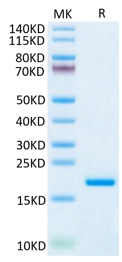 Human IL-20 on Tris-Bis PAGE under reduced condition. The purity is greater than 95%.Recombinant Human IL-20 Protein