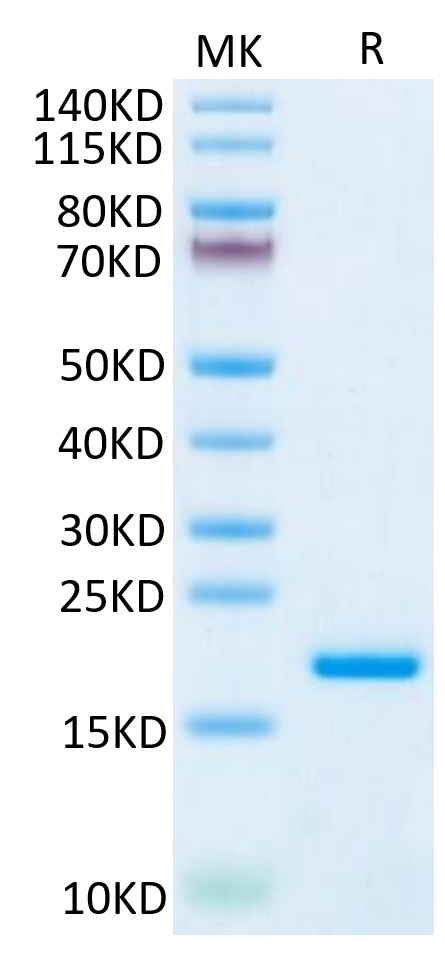 Human IL-20 on Tris-Bis PAGE under reduced condition. The purity is greater than 95%.Recombinant Human IL-20 Protein