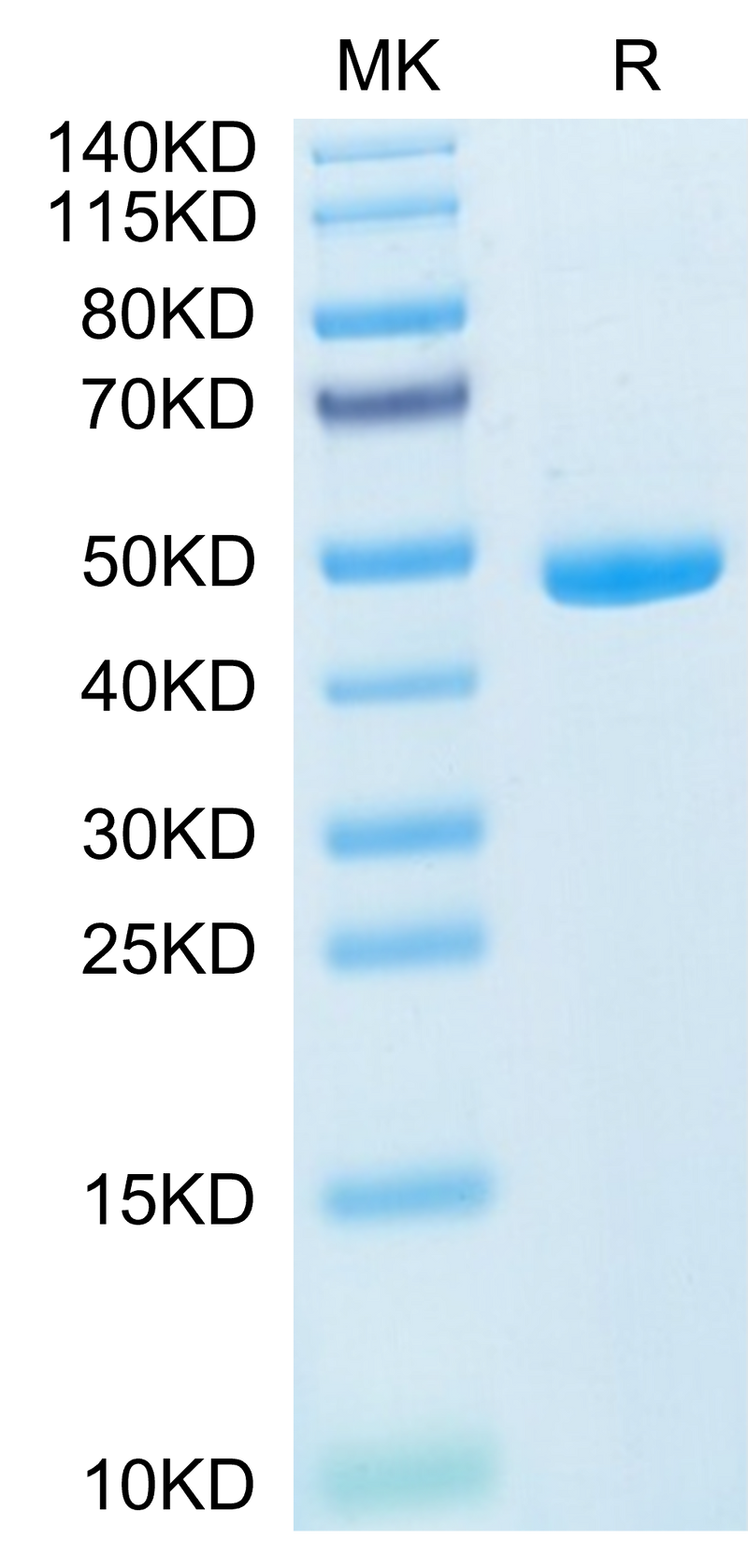 Mouse IL-20 on Tris-Bis PAGE under reduced condition. The purity is greater than 95%.Recombinant Mouse IL-20 Protein