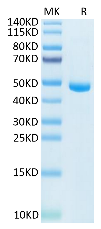 Human IL-20 on Tris-Bis PAGE under reduced condition. The purity is greater than 95%.Recombinant Human IL-20 Protein