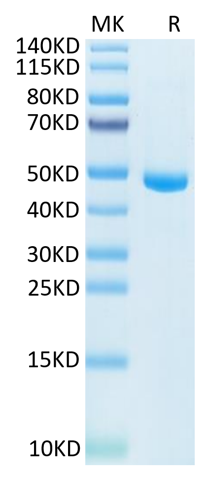 Human IL-20 on Tris-Bis PAGE under reduced condition. The purity is greater than 95%.Recombinant Human IL-20 Protein