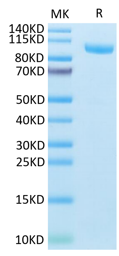 Mouse CDH17 on Tris-Bis PAGE under reduced condition. The purity is greater than 95%.Recombinant Mouse CDH17/Cadherin 17 Protein