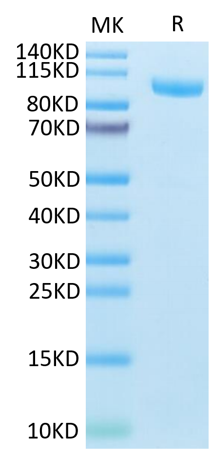 Mouse CDH17 on Tris-Bis PAGE under reduced condition. The purity is greater than 95%.Recombinant Mouse CDH17/Cadherin 17 Protein