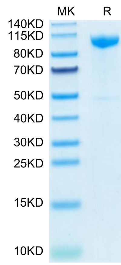 Human CDH17 on Tris-Bis PAGE under reduced condition. The purity is greater than 95%.Recombinant Human CDH17/Cadherin 17 Protein, Active