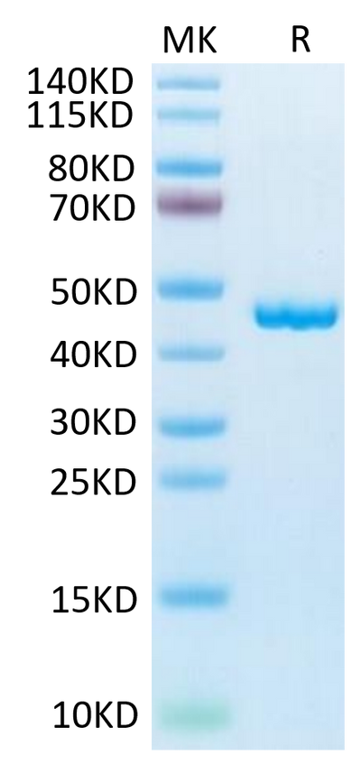 Mouse SLPI on Tris-Bis PAGE under reduced condition. The purity is greater than 95%.Recombinant Mouse SLPI Protein