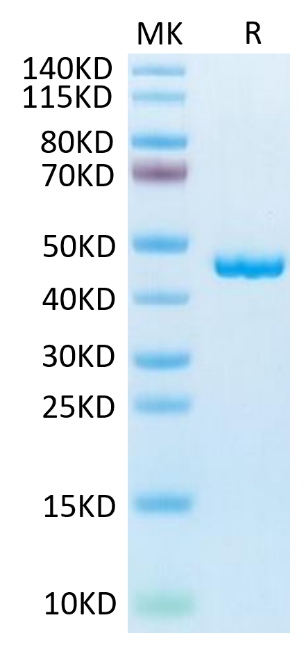Mouse SLPI on Tris-Bis PAGE under reduced condition. The purity is greater than 95%.Recombinant Mouse SLPI Protein