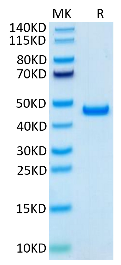 Human SLPI on Tris-Bis PAGE under reduced condition. The purity is greater than 95%.Recombinant Human SLPI Protein, Active
