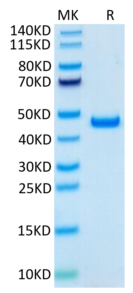 Human SLPI on Tris-Bis PAGE under reduced condition. The purity is greater than 95%.Recombinant Human SLPI Protein, Active