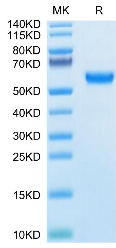 Human SPP1 on Tris-Bis PAGE under reduced condition. The purity is greater than 95%.Recombinant Human SPP1/OPN Protein