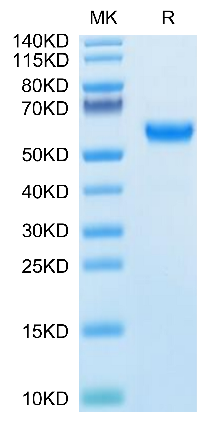 Human SPP1 on Tris-Bis PAGE under reduced condition. The purity is greater than 95%.Recombinant Human SPP1/OPN Protein