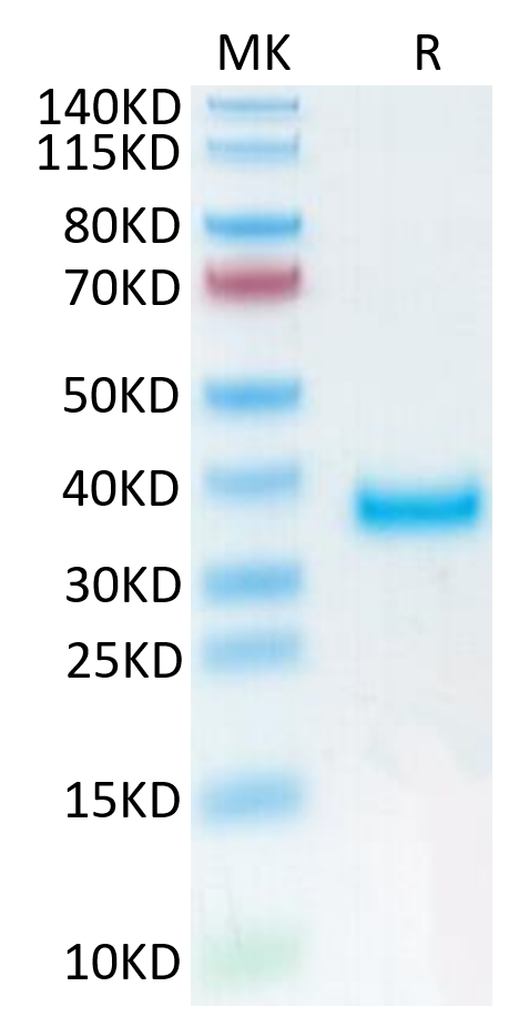 Human PRLR on Tris-Bis PAGE under reduced condition. The purity is greater than 95%.Recombinant Human PRLR Protein, Active