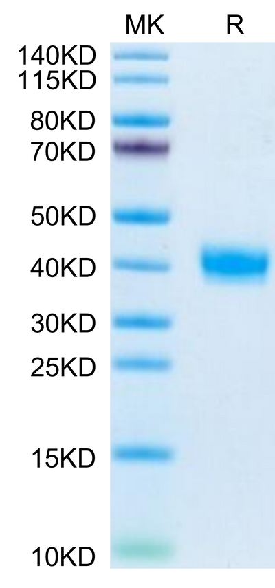 Mouse PRLR on Tris-Bis PAGE under reduced condition. The purity is greater than 95%.Recombinant Mouse PRLR Protein