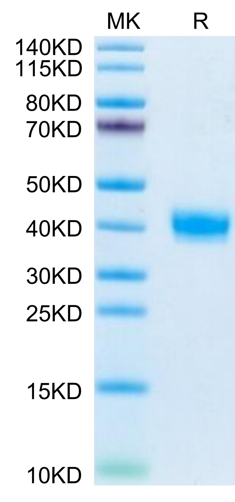 Mouse PRLR on Tris-Bis PAGE under reduced condition. The purity is greater than 95%.Recombinant Mouse PRLR Protein
