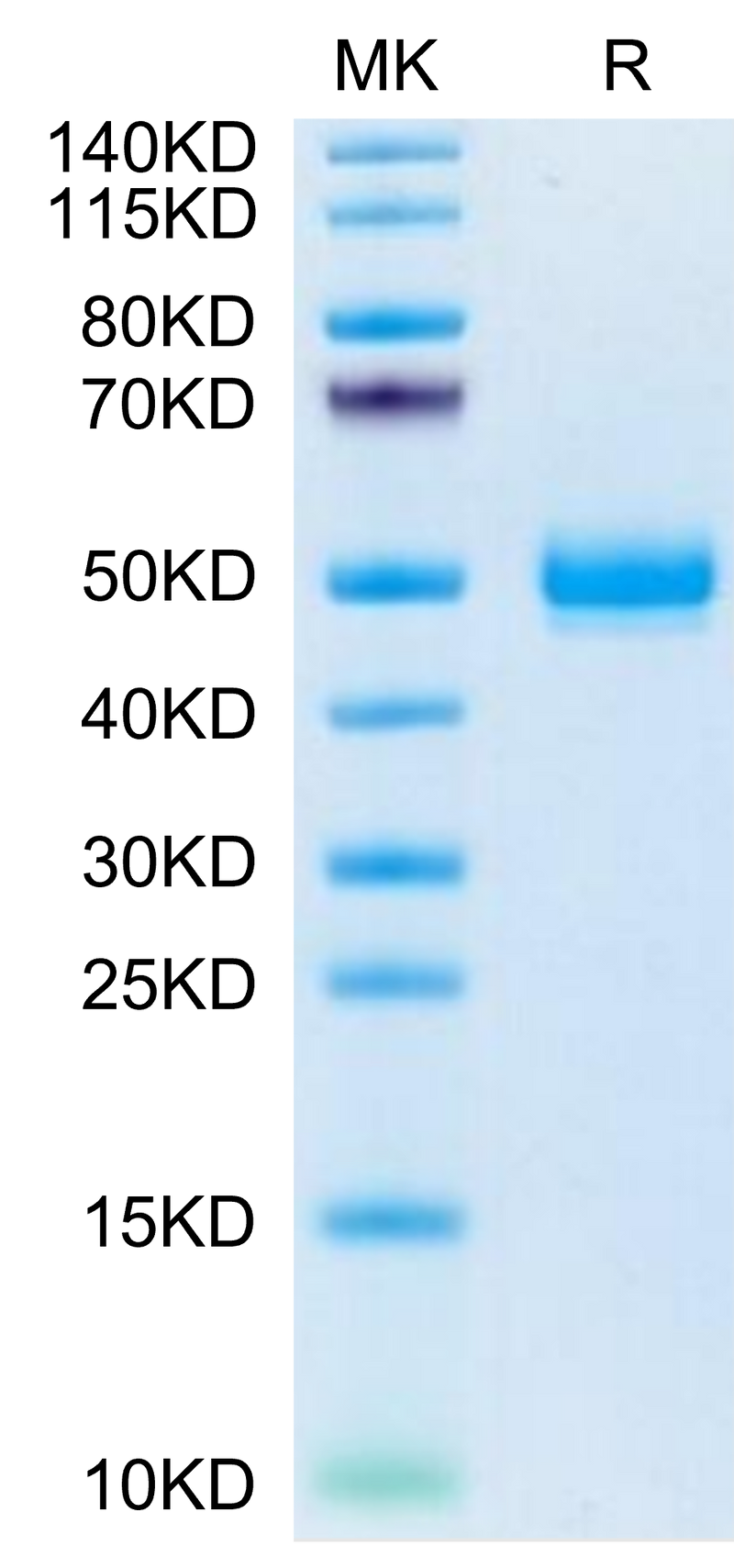 Mouse EPHA5 on Tris-Bis PAGE under reduced condition. The purity is greater than 95%.Recombinant Mouse EPHA5 Protein