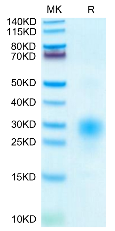 Human BST2 on Tris-Bis PAGE under reduced condition. The purity is greater than 95%.Recombinant Human BST2 Protein, Active
