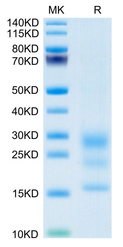 Mouse BST2 on Tris-Bis PAGE under reduced condition. The purity is greater than 95%.Recombinant Mouse BST2 Protein
