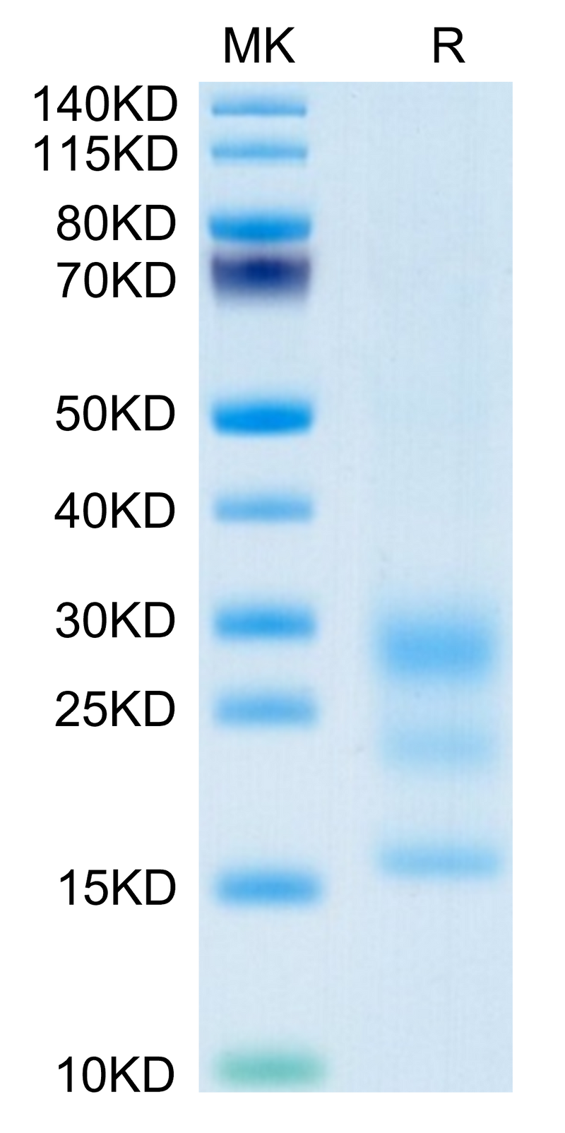 Mouse BST2 on Tris-Bis PAGE under reduced condition. The purity is greater than 95%.Recombinant Mouse BST2 Protein