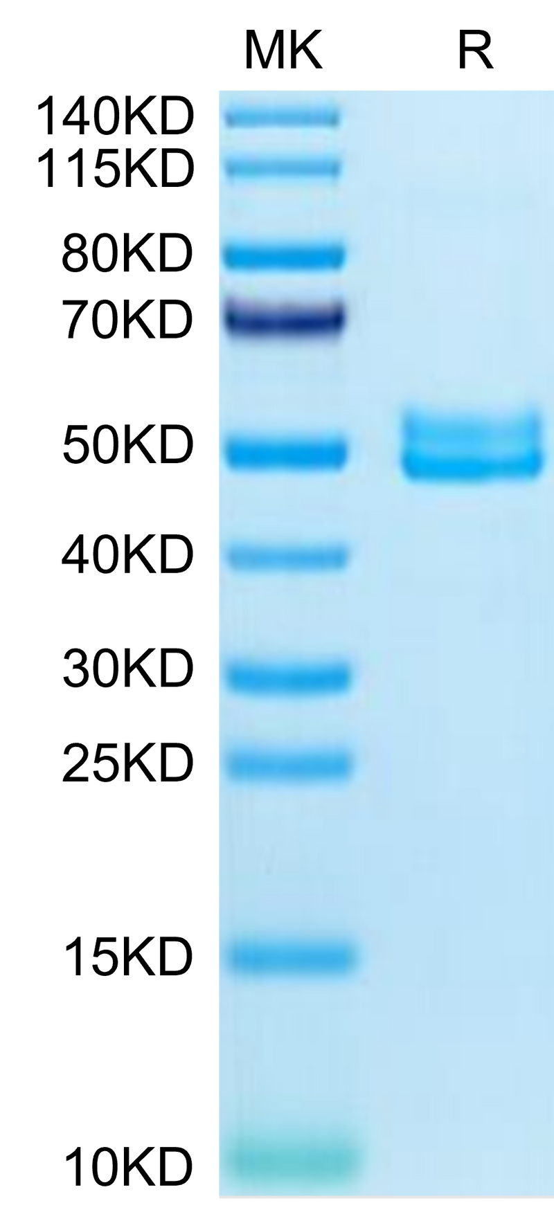 Mouse BST2 on Tris-Bis PAGE under reduced condition. The purity is greater than 95%.Recombinant Mouse BST2 Protein