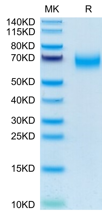 Human CD300A on Tris-Bis PAGE under reduced condition. The purity is greater than 95%.Recombinant Human CD300A Protein, Active